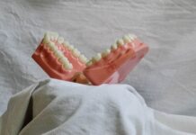 Legătura dintre stres, anxietate, bruxism și inflamația gingivală bruxism